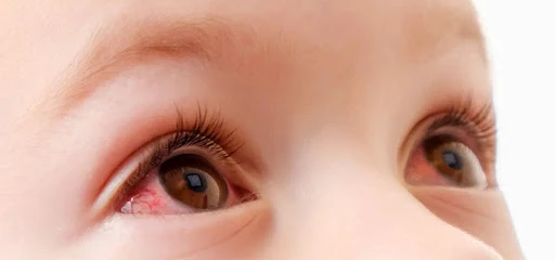  Первые признаки ОРВИ